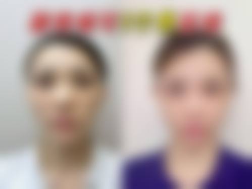 钱汉根医生项目收费价格