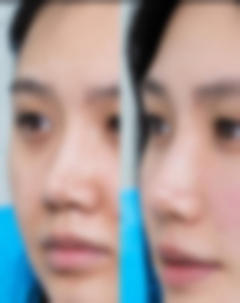 钟俊医生项目收费价格