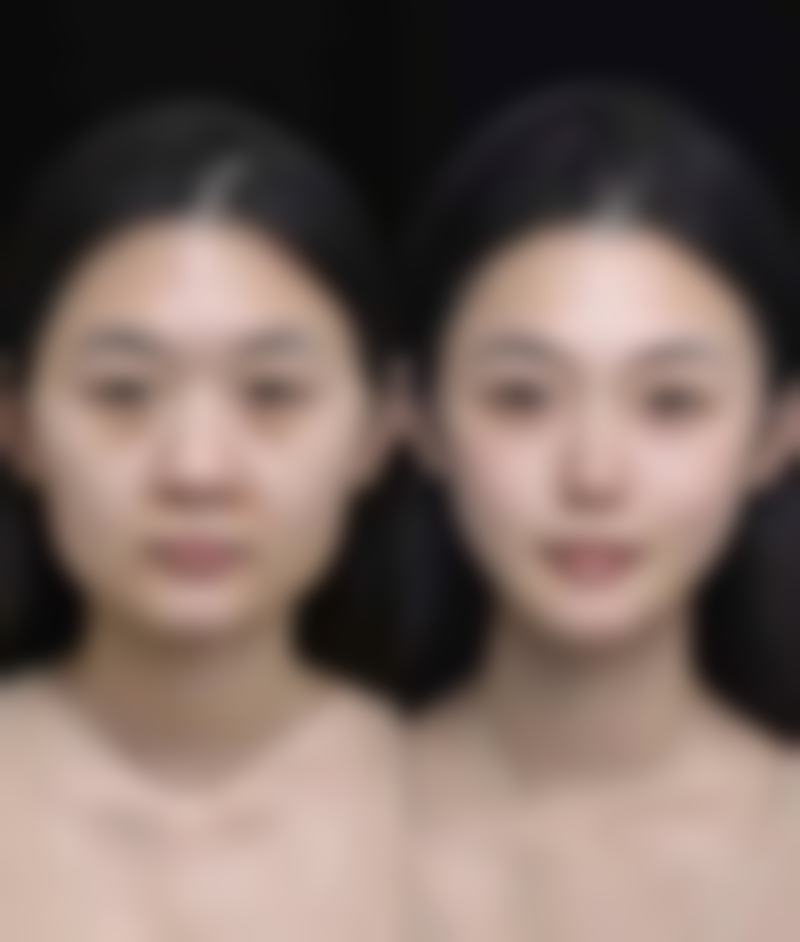 南京静晟熙整形医院收费价格表