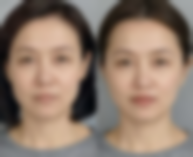 福州中意整形医院医生团队介绍