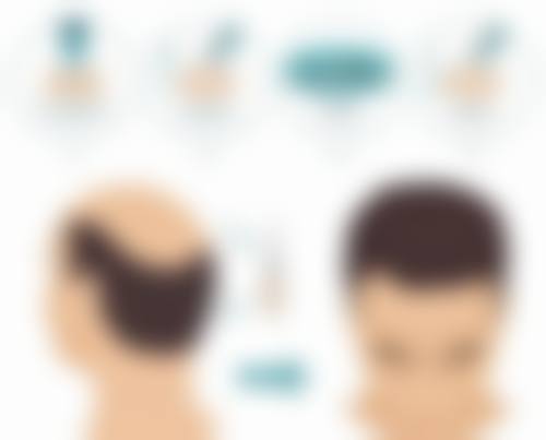 兰州新禾铭秀植发医院地址电话、营业时间