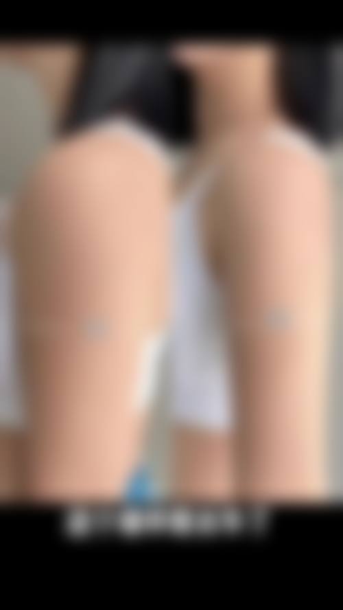 陶鹏医生项目收费价格