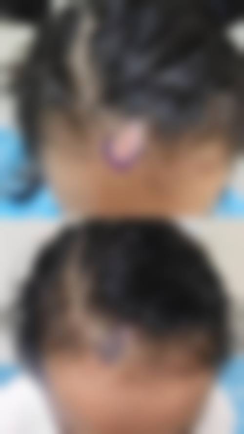 南宁肤康皮肤医院收费价格表