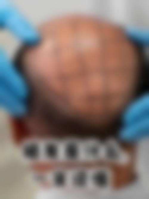 南宁肤康皮肤医院特色诊疗项目与技术优势