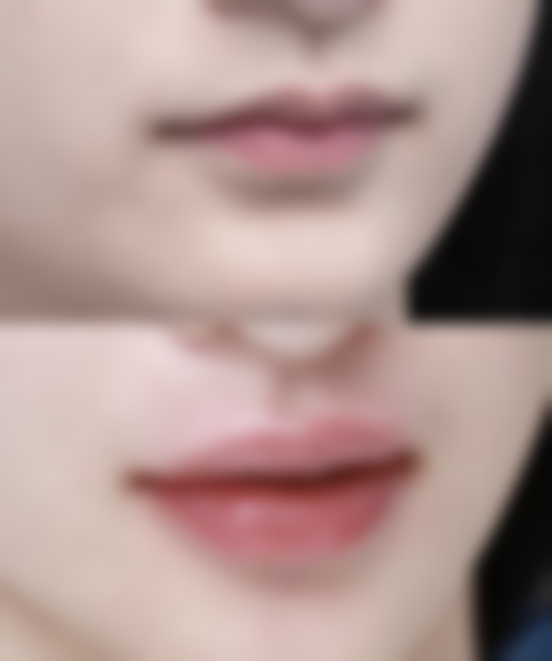 王旭华医生技术优势