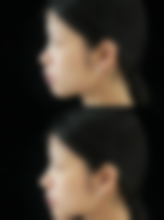 安阳市丽莎美容中 心收费价格表