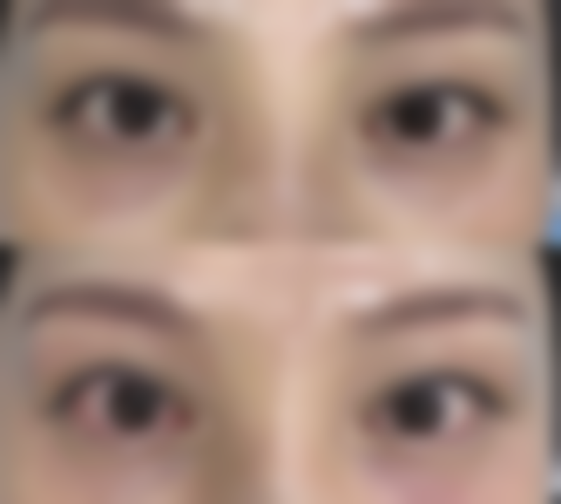 上海悦莱医疗美容收费价格表