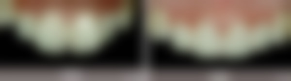 洪经国医生项目收费价格