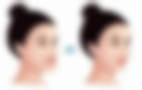 郑晓明医生技术优势