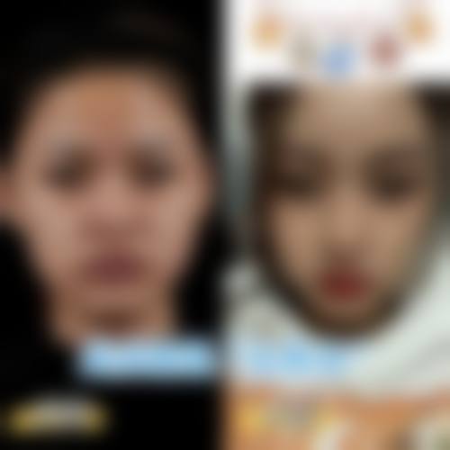 方明松医生项目收费价格