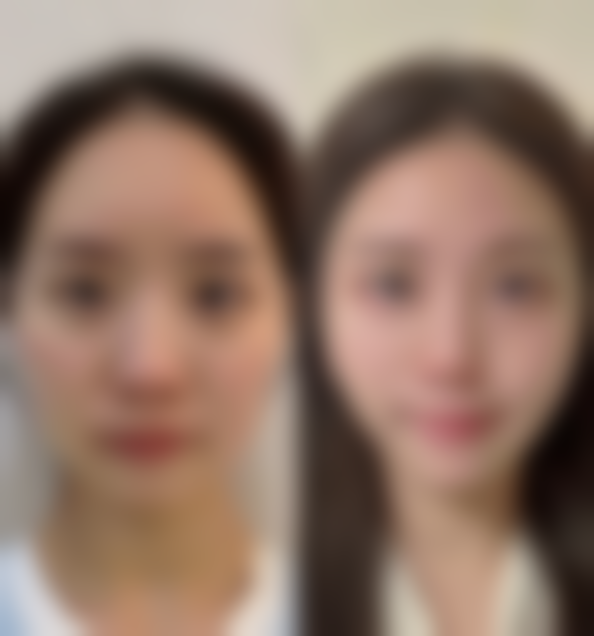 南京张东医学整形美容医院收费价格表