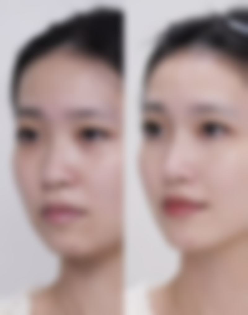 艺颂耳鼻喉医院特色诊疗项目与技术优势