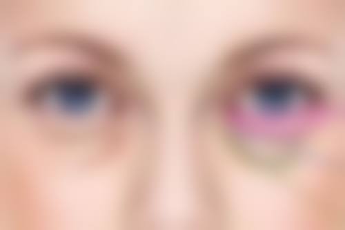 付小平医生技术优势