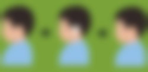 郑华 山医生技术优势