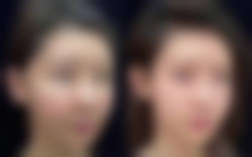 陈朗医生预约挂号