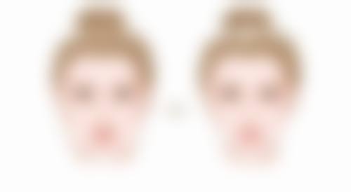 郑华 山医生项目收费价格