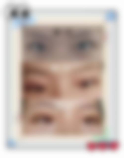 任丽虹医生项目收费价格