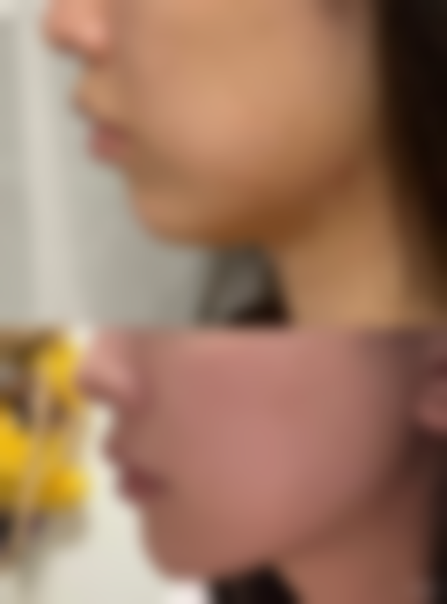 李占营医生项目收费价格