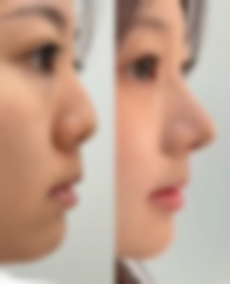 杭州美悦盛星整形医院收费价格表