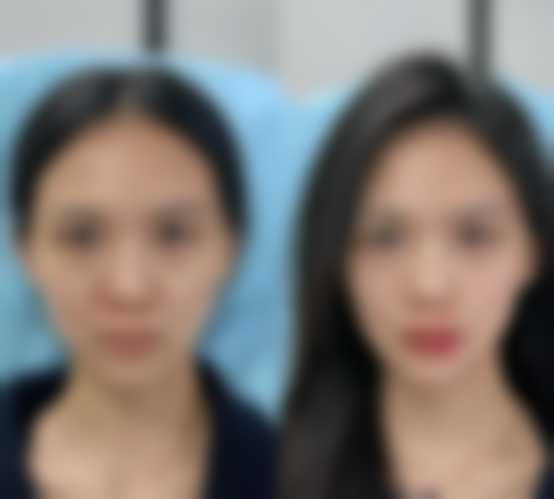 严苗苗医生预约挂号