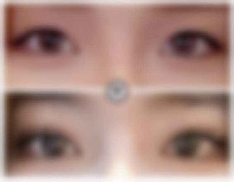 沈阳孟强整形美容诊所收费价格表