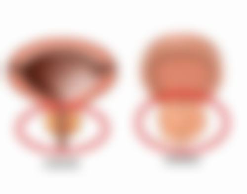 卢植生医生技术优势