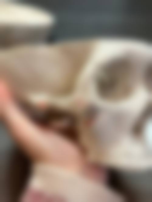 朴竟元医生项目收费价格