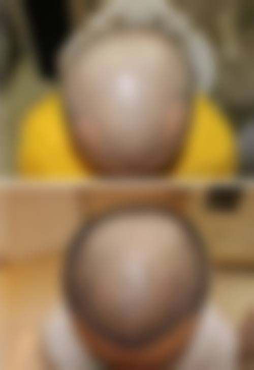 台州大麦微针植发医疗环境与配套设施