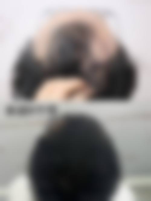 台州大麦微针植发医生团队介绍