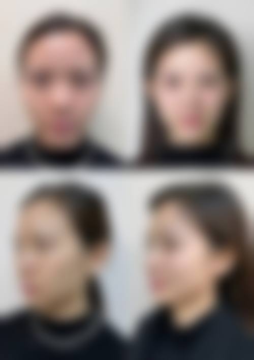 徐学武医生项目收费价格