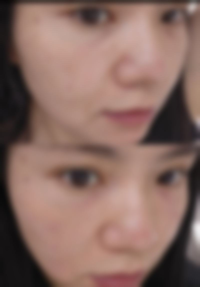 PHD皮肤科收费价格表