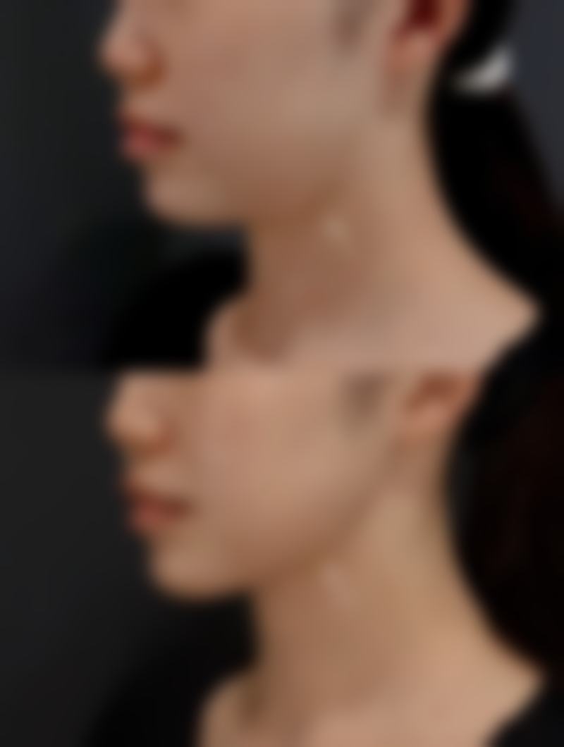 杭州美若星辰（星美汇）医疗美容门诊部收费价格表