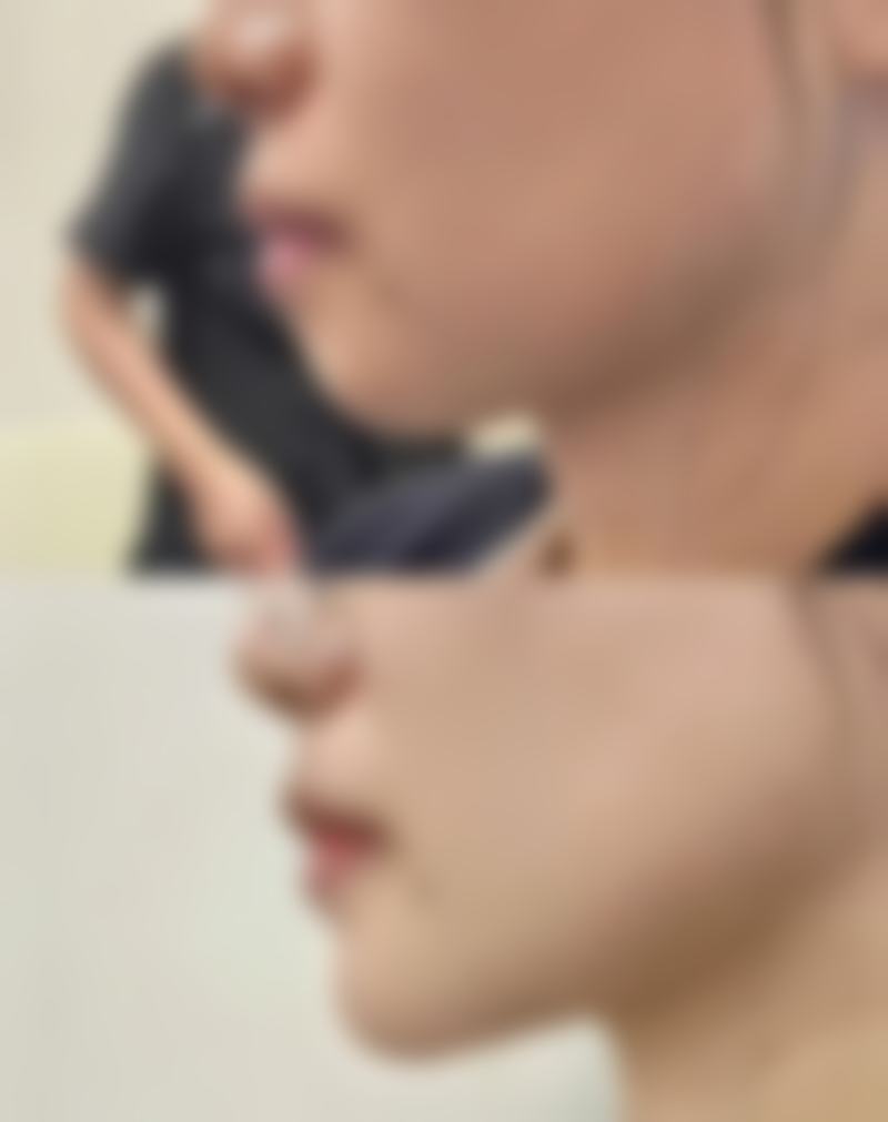 PHD皮肤科特色诊疗项目与技术优势