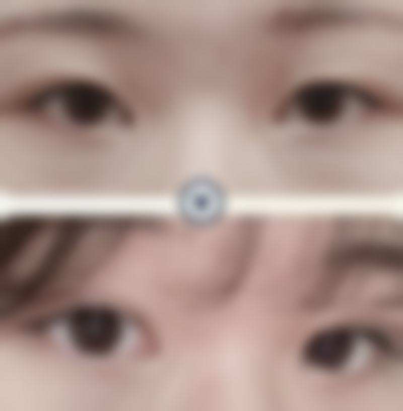 西安辛西娅昕颜整形医院收费价格表