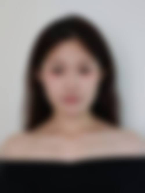 张解生医生预约挂号