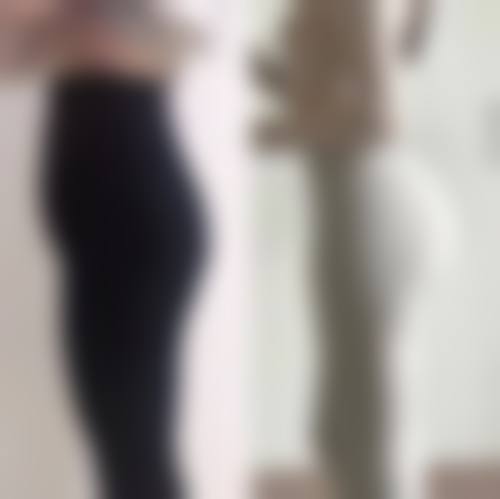 陶鹏医生项目收费价格