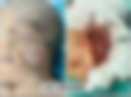 钱汉根医生项目收费价格