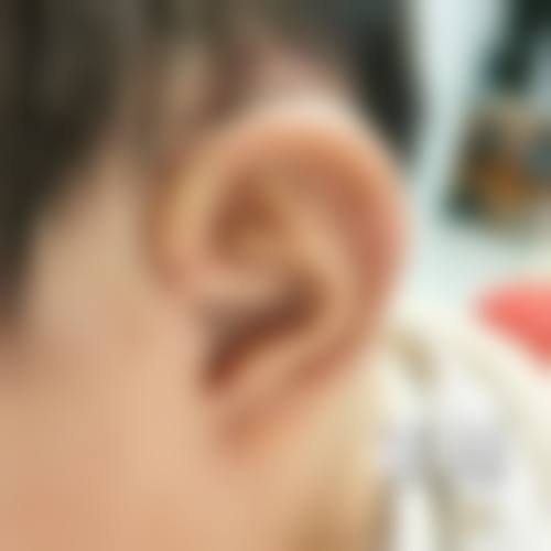 褚燕军 医生技术优势