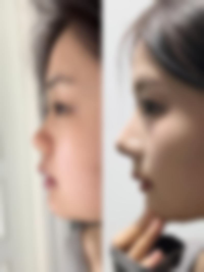 西安时光美容医院收费价格表