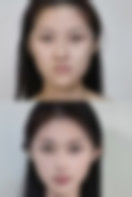 钟俊医生项目收费价格