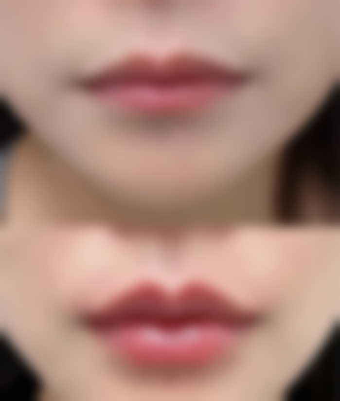 王旭华医生项目收费价格