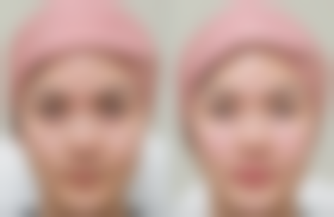 韩国春光整形外科医疗环境与配套设施