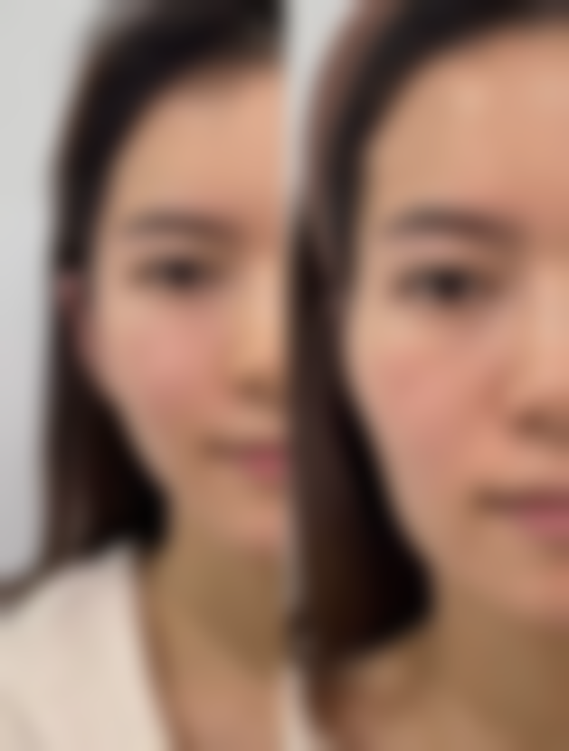 江苏连云港中整整形医院收费价格表