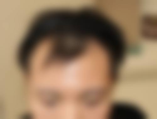 赵成仁医生技术优势