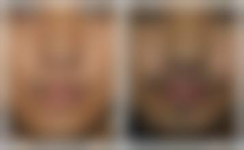 赵成仁医生预约挂号