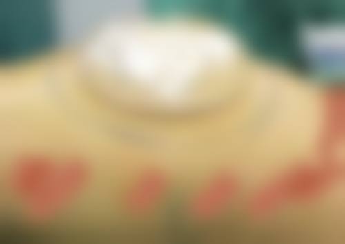 祁强医生项目收费价格