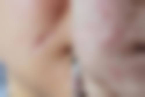 赵成仁医生项目收费价格