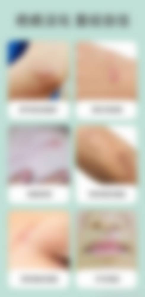 齐向梅医生技术优势