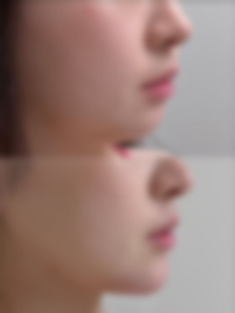 十堰维纳斯整形预约挂号方式