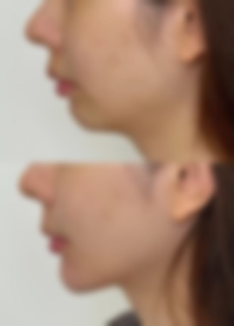 肖云尧医生项目收费价格